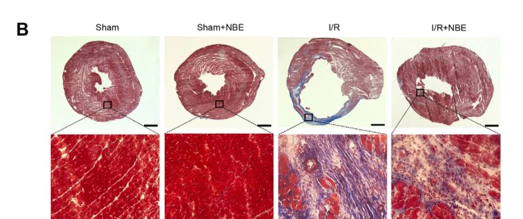 Heart cross-sections three months after induced heart attack in aged mice, stained with Masson's trichrome. Blue indicates fibrotic scarring. The heart that received plasma dilution (right) shows dramatically less damage than the untreated heart (third from left). Close-up panels below show tissue-level detail. From Cruz et al., Aging Cell 2026.