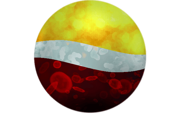 Global Apheresis — Therapeutic Plasma Exchange
