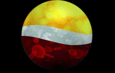 Global Apheresis — Therapeutic Plasma Exchange